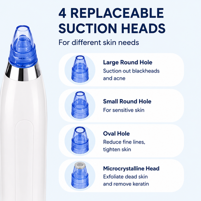 Portable Blackhead Remover Vacuum – 3-Level Facial Pore Cleaner for Deep Skin Cleansing